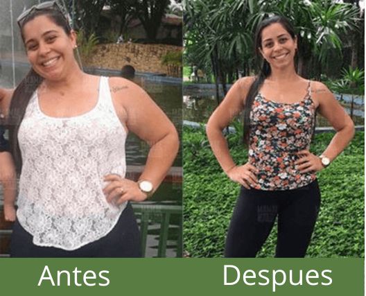Ana Paula - Antes y Después